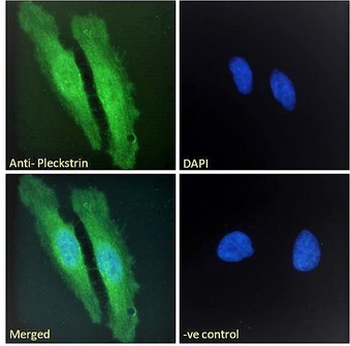 PLEK/Pleckstrin Antibody
