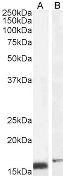 RBP1/CRBP Antibody