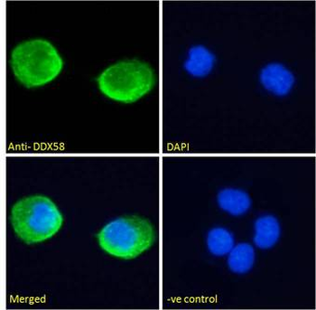 DDX58/RIG-1/RIG-I Antibody