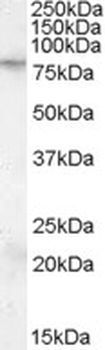 FMR1/FMRP Antibody