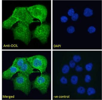 CLEC2D/OCIL/LLT1 Antibody