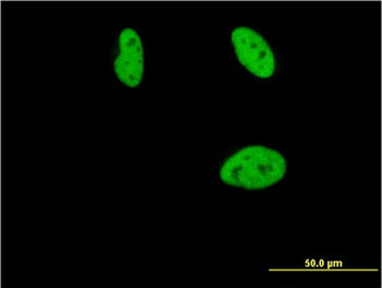 CBFA1/RUNX2 Antibody