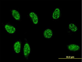 TSC22D3/GILZ Antibody