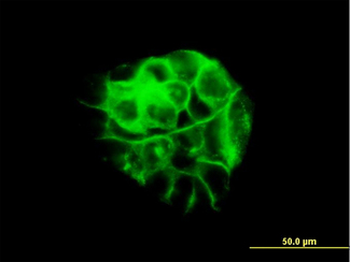 JUP/CTNNG/Junction Plakoglobin Antibody