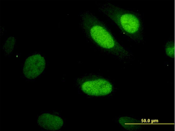 YAP/YAP1 Antibody
