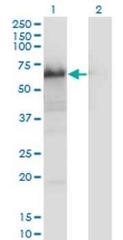 YAP/YAP1 Antibody
