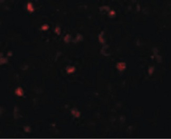 TMEM16B/ANO2 Antibody