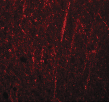 FRMPD4 Antibody