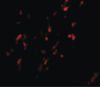 BCAS1/NABC1 Antibody
