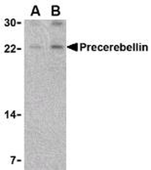 CBLN1/Cerebellin 1 Antibody
