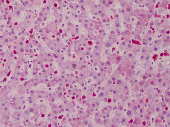 CARMA1/CARD11 Antibody