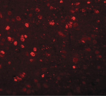 SYNGR1/Synaptogyrin 1 Antibody