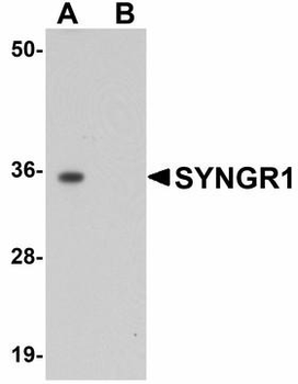 SYNGR1/Synaptogyrin 1 Antibody