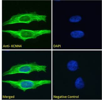 KCNN4/KCa3.1 Antibody