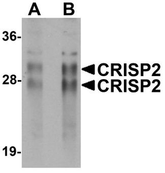 CRISP2/TSP1 Antibody