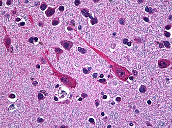 PCSK1 Antibody