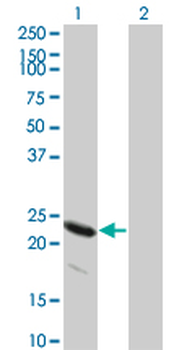 HSPB8/H11/HSP22 Antibody
