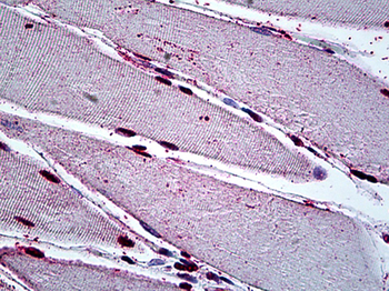 GAX/MEOX2 Antibody