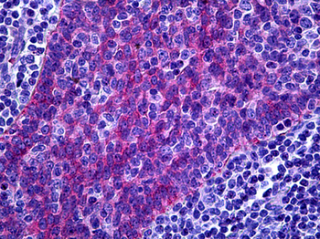 FREM1 Antibody