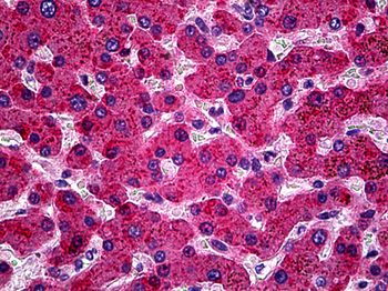 APOH/Apolipoprotein H Antibody