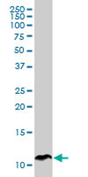 SPINK1 Antibody