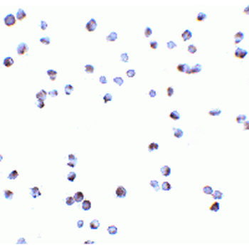 DAPK3/ZIP Kinase Antibody