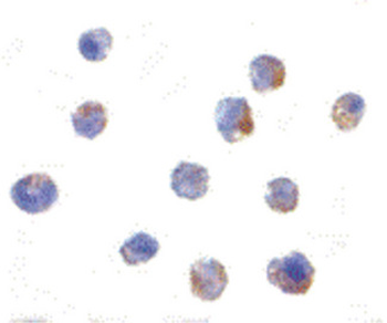 IKBKAP/IKAP Antibody