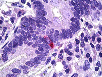 PPY/Pancreatic Polypeptide Antibody