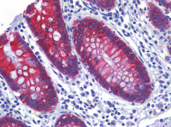 CDH17/Cadherin 17 Antibody