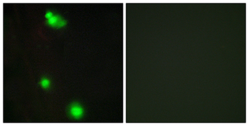 SRSF3/SRP20 Antibody