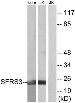 SRSF3/SRP20 Antibody