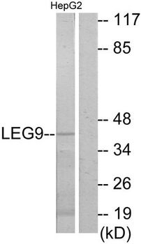 LGALS9/Galectin 9 Antibody