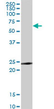 TNFRSF18/GITR Antibody