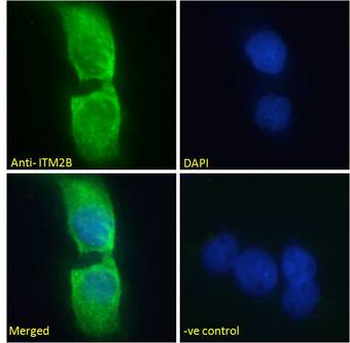 ABRI/ITM2B Antibody