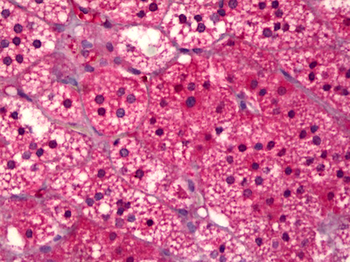 SUCNR1/GPR91 Antibody