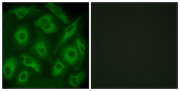CDH23/Cadherin 23 Antibody