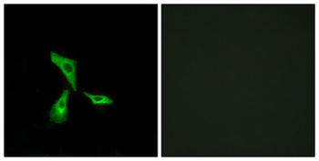 GPCR6/GPR101 Antibody