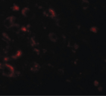 AXIN1/Axin-1 Antibody