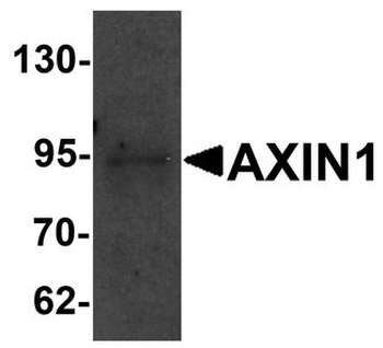 AXIN1/Axin-1 Antibody