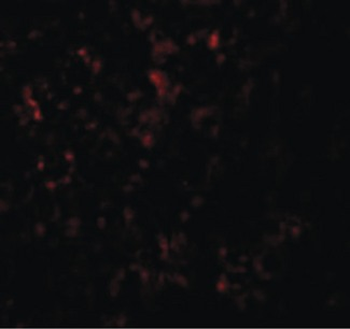 SLC39A14/ZIP14 Antibody