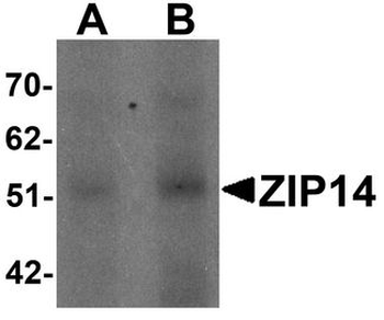 SLC39A14/ZIP14 Antibody