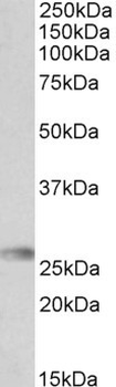 HLA-DQA2 Antibody