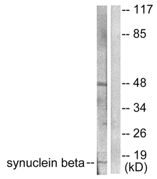SNCB/Beta-Synuclein Antibody