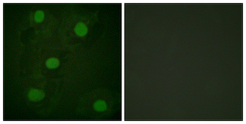 TP53/p53 Antibody
