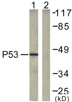 TP53/p53 Antibody