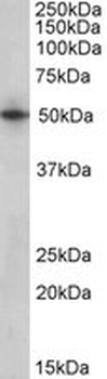 SEPT4/Septin 4 Antibody