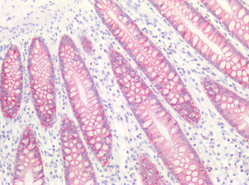 CLDN4/Claudin 4 Antibody