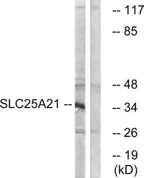 SLC25A21/ODC1 Antibody