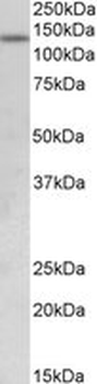 JHDM1A/KDM2A Antibody