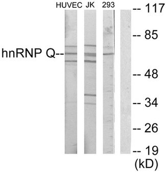 SYNCRIP/HnRNP Q Antibody